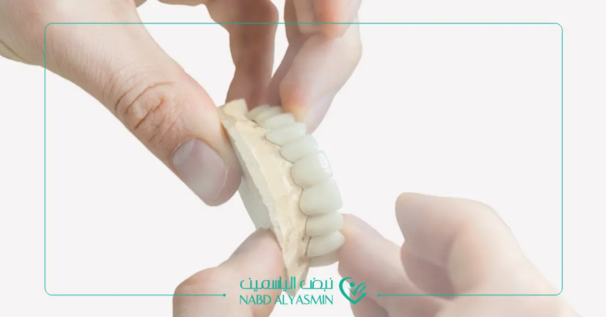 تركيبات الأسنان الثابتة